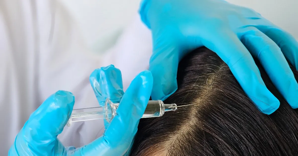 women receiving Keralase® Hair Restoration in New Fairfield, CT