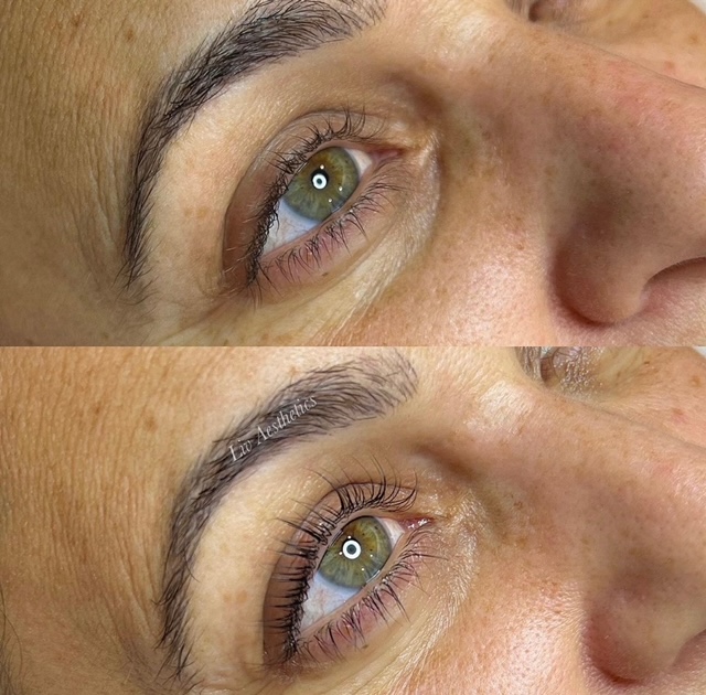 Brows Lashes Before and After Photo by Liv Aesthetics Medical Spa in New Fairfield CT