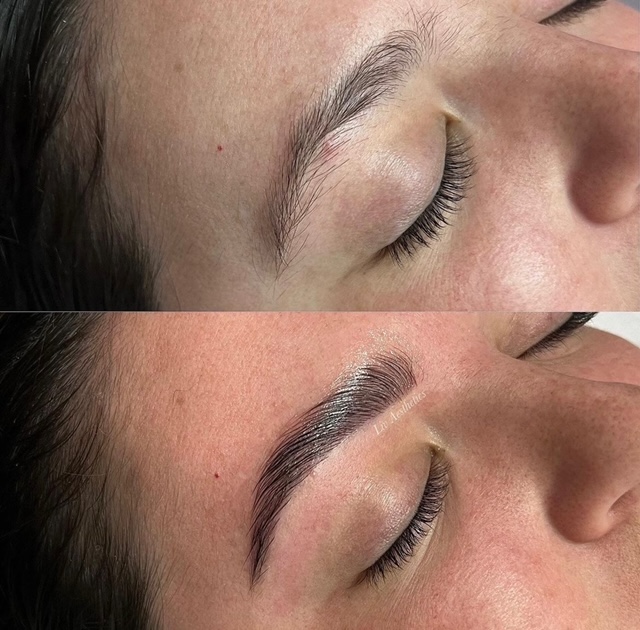 Brows Lashes Before and After Photo by Liv Aesthetics Medical Spa in New Fairfield CT
