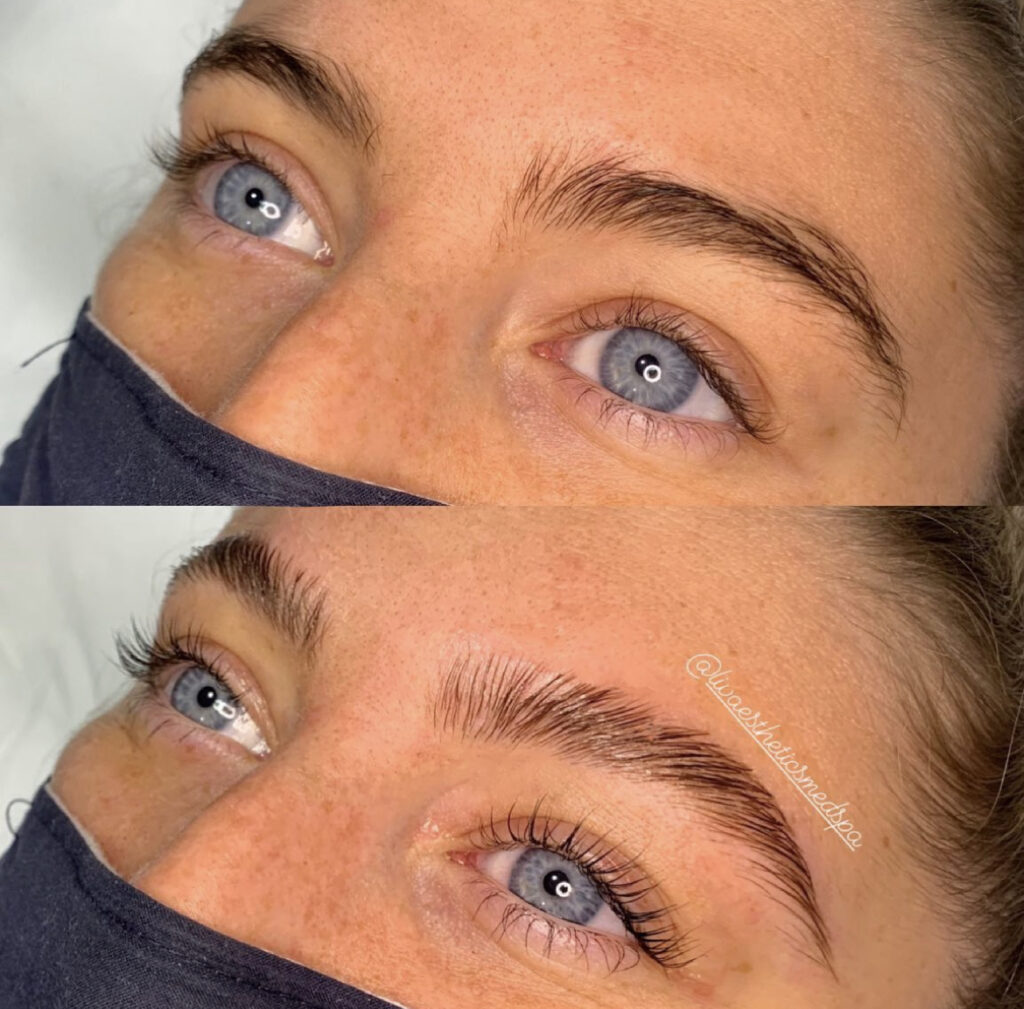 Brow Lamination and Lash Lift & Tint before and after photo by Liv Aesthetics Medical Spa in New Fairfield, CT