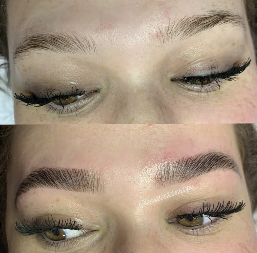 Brow Lamination before and after photo by Liv Aesthetics Medical Spa in New Fairfield, CT