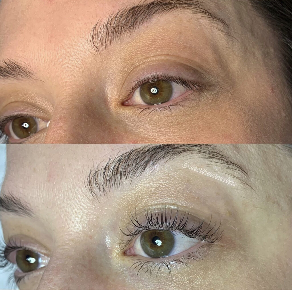 Lash Lamination and Lash Lift & Tint before and after photo by Liv Aesthetics Medical Spa in New Fairfield, CT